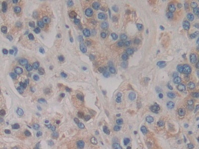 Immunohistochemistry (Formalin/PFA-fixed paraffin-embedded sections) - Anti-HPR antibody (AB233006)
