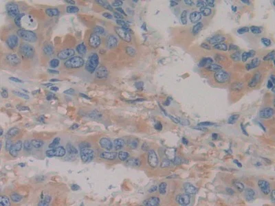 Immunohistochemistry (Formalin/PFA-fixed paraffin-embedded sections) - Anti-HPR antibody (AB233006)