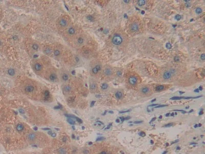 Immunohistochemistry (Formalin/PFA-fixed paraffin-embedded sections) - Anti-HPR antibody (AB233006)