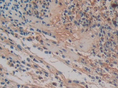 Immunohistochemistry (Formalin/PFA-fixed paraffin-embedded sections) - Anti-HPR antibody (AB233006)
