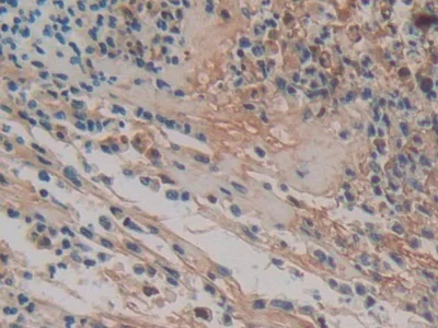 Immunohistochemistry (Formalin/PFA-fixed paraffin-embedded sections) - Anti-HPR antibody (AB233006)