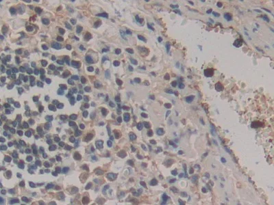 Immunohistochemistry (Formalin/PFA-fixed paraffin-embedded sections) - Anti-HPR antibody (AB233006)