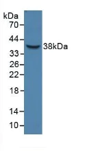 Western blot - Anti-HPR antibody (AB233006)