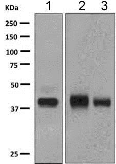 Western blot - Anti-HPR antibody [EPR9829] (AB151752), expandable thumbnail