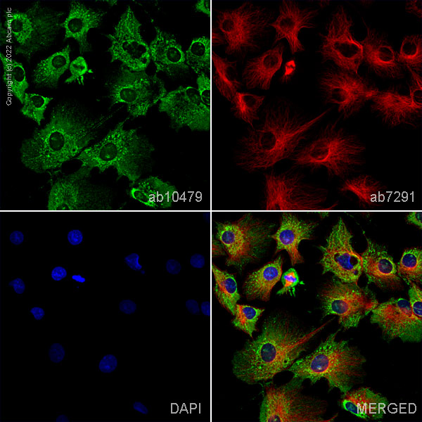 Immunocytochemistry/ Immunofluorescence - Anti-HPRT antibody (ab10479), expandable thumbnail