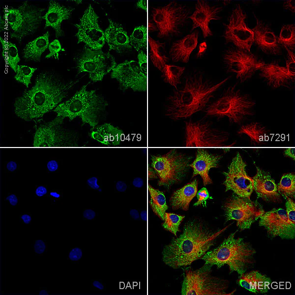 Immunocytochemistry/ Immunofluorescence - Anti-HPRT antibody (AB10479)