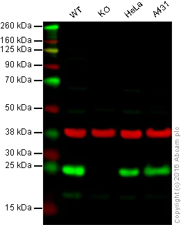 Western blot - Anti-HPRT antibody (AB10479)