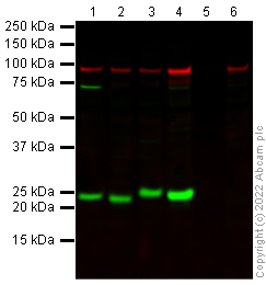 Western blot - Anti-HPRT antibody (ab10479), expandable thumbnail