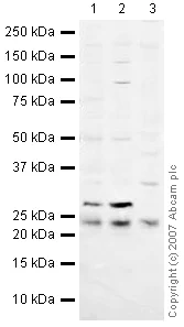 Western blot - Anti-HPRT antibody (AB10479)
