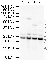 Western blot - Anti-HPRT antibody (AB10479)