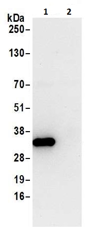 Immunoprecipitation - Anti-HPRT antibody (AB226412)