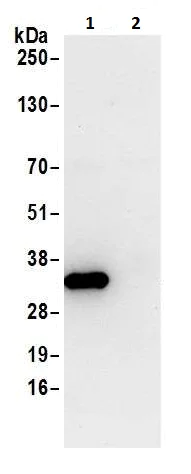Immunoprecipitation - Anti-HPRT antibody (AB226412)
