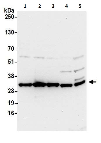 Western blot - Anti-HPRT antibody (AB226412)