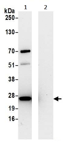Immunoprecipitation - Anti-HPRT antibody (AB245397), expandable thumbnail