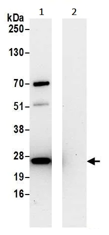 Immunoprecipitation - Anti-HPRT antibody (AB245397)