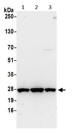 Western blot - Anti-HPRT antibody (AB245397), expandable thumbnail
