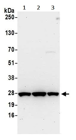 Western blot - Anti-HPRT antibody (AB245397)