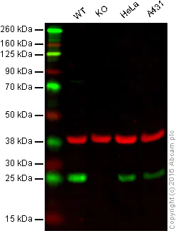 Western blot - Anti-HPRT antibody [EPR5298] - BSA and Azide free (AB240051)