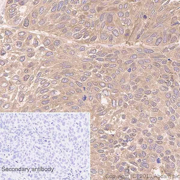 Immunohistochemistry (Formalin/PFA-fixed paraffin-embedded sections) - Anti-HPRT antibody [EPR5299] (AB109021)