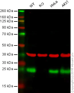 Western blot - Anti-HPRT antibody [EPR5299] (AB109021)
