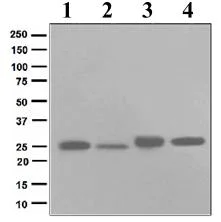Western blot - Anti-HPRT antibody [EPR5299] (AB109021)