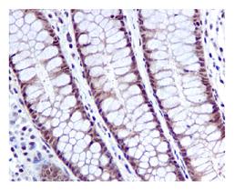 Immunohistochemistry (Formalin/PFA-fixed paraffin-embedded sections) - Anti-HPRT antibody [EPR5299] - BSA and Azide free (AB236055)
