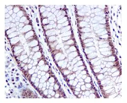 Immunohistochemistry (Formalin/PFA-fixed paraffin-embedded sections) - Anti-HPRT antibody [EPR5299] - BSA and Azide free (AB236055)