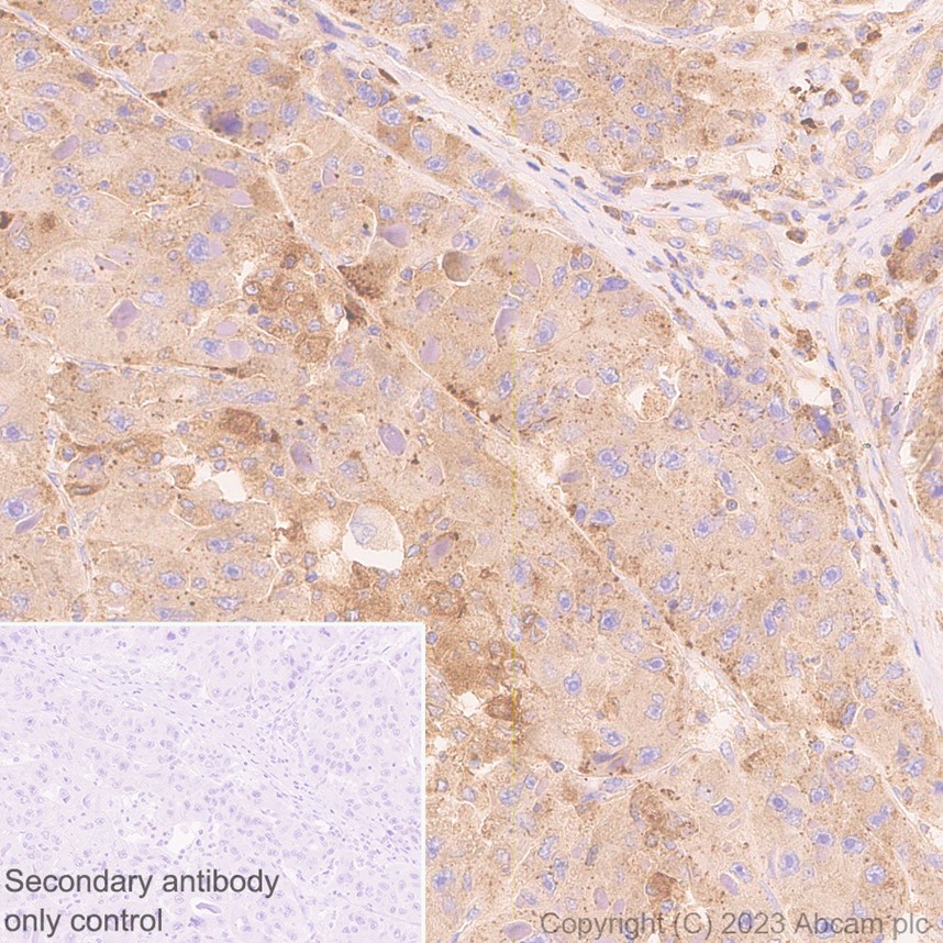 Immunohistochemistry (Formalin/PFA-fixed paraffin-embedded sections) - Anti-HPS1 antibody [EP8429(2)] (AB174301), expandable thumbnail