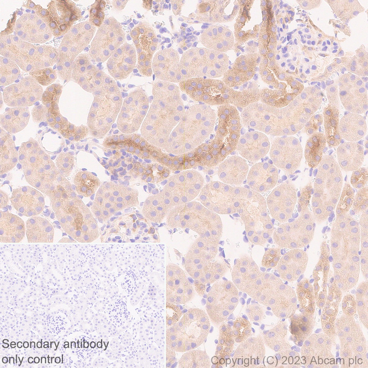 Immunohistochemistry (Formalin/PFA-fixed paraffin-embedded sections) - Anti-HPS1 antibody [EP8429(2)] (AB174301), expandable thumbnail