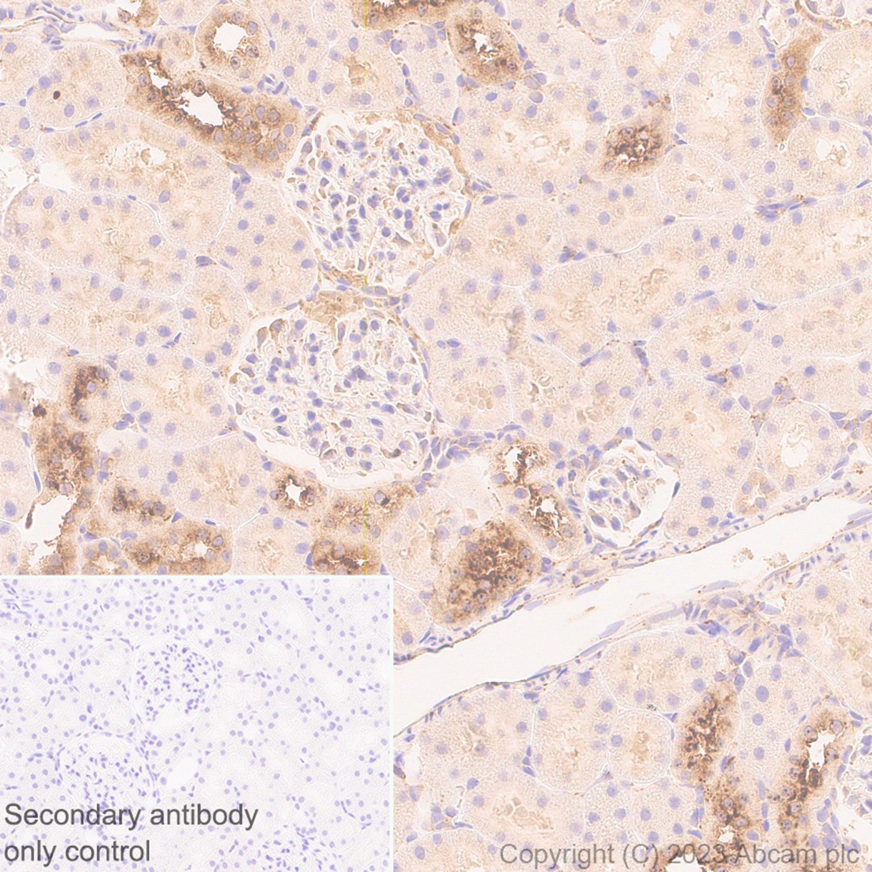 Immunohistochemistry (Formalin/PFA-fixed paraffin-embedded sections) - Anti-HPS1 antibody [EP8429(2)] (ab174301), expandable thumbnail