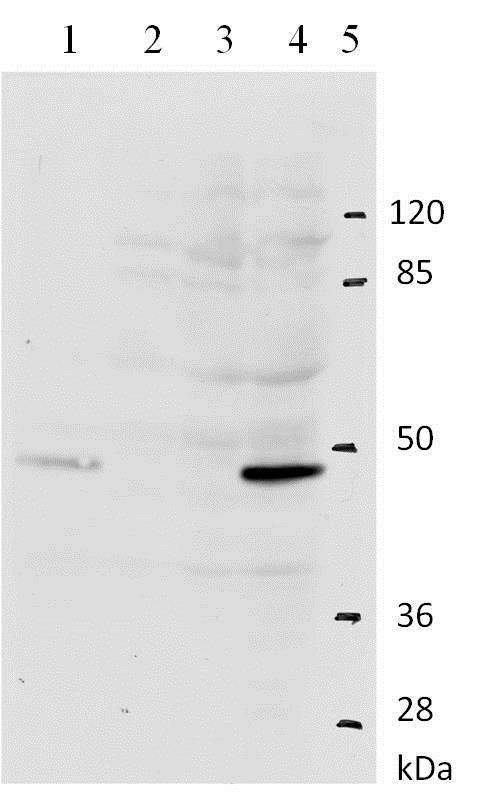 Western blot - Anti-HPV11 E2 antibody [10E12] (AB100968), expandable thumbnail