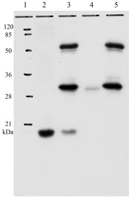 Immunoprecipitation - Anti-HPV11 E7 antibody [9H5] (AB100967)
