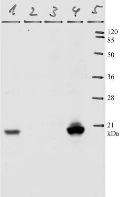 Western blot - Anti-HPV11 E7 antibody [9H5] (AB100967)