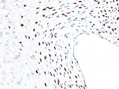 Immunohistochemistry (Formalin/PFA-fixed paraffin-embedded sections) - Anti-HPV16 antibody [HPV16L1/1058] - BSA and Azide free (AB234030), expandable thumbnail