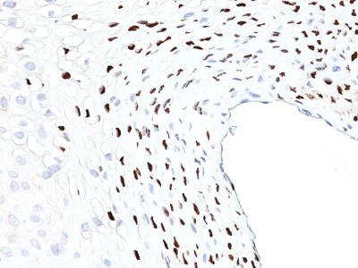 Immunohistochemistry (Formalin/PFA-fixed paraffin-embedded sections) - Anti-HPV16 antibody [HPV16L1/1058] - BSA and Azide free (AB234030)