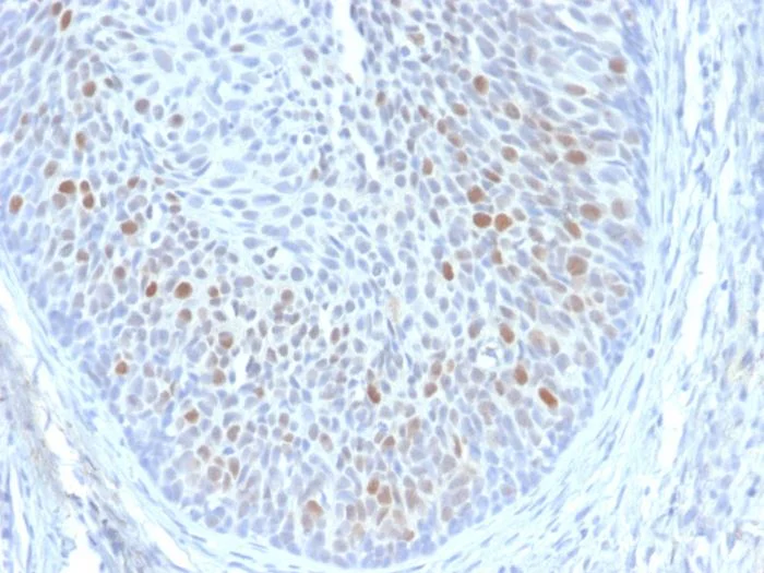 Immunohistochemistry (Formalin/PFA-fixed paraffin-embedded sections) - Anti-HPV16 E1+E4 antibody [HPV16 E1/E4] (AB270738)