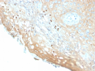 Immunohistochemistry (Formalin/PFA-fixed paraffin-embedded sections) - Anti-HPV16 L1 antibody [HPV16/2058R] - BSA and Azide free (AB236310)