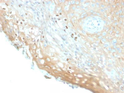 Immunohistochemistry (Formalin/PFA-fixed paraffin-embedded sections) - Anti-HPV16 L1 antibody [HPV16/2058R] - BSA and Azide free (AB236310)