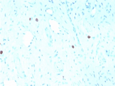 Immunohistochemistry (Formalin/PFA-fixed paraffin-embedded sections) - Anti-HPV16 L1 antibody [rHPV16L1/1058] (AB234309), expandable thumbnail
