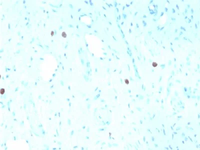 Immunohistochemistry (Formalin/PFA-fixed paraffin-embedded sections) - Anti-HPV16 L1 antibody [rHPV16L1/1058] (AB234309)