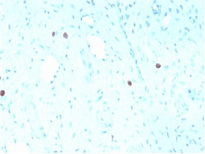 Immunohistochemistry (Formalin/PFA-fixed paraffin-embedded sections) - Anti-HPV16 L1 antibody [rHPV16L1/1058] - BSA and Azide free (AB236304)