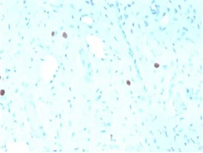 Immunohistochemistry (Formalin/PFA-fixed paraffin-embedded sections) - Anti-HPV16 L1 antibody [rHPV16L1/1058] - BSA and Azide free (AB236304)