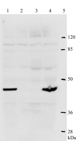 Western blot - Anti-HPV18 E2 antibody [2E7] (AB100969)