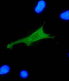 Immunocytochemistry/ Immunofluorescence - Anti-HPV18 E7 antibody [8E2] (AB100953), expandable thumbnail