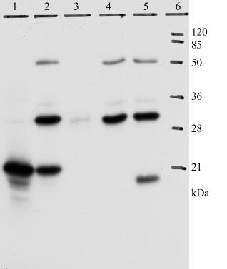 Immunoprecipitation - Anti-HPV18 E7 antibody [8E2] (AB100953), expandable thumbnail