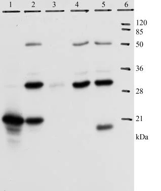Immunoprecipitation - Anti-HPV18 E7 antibody [8E2] (AB100953)