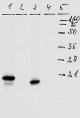 Western blot - Anti-HPV18 E7 antibody [8E2] (AB100953), expandable thumbnail