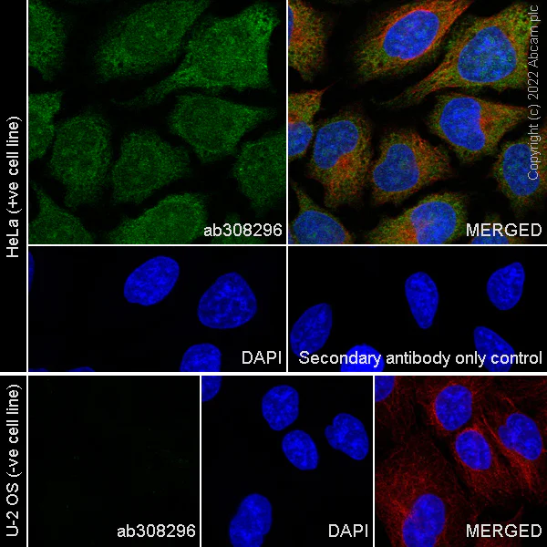 Immunocytochemistry/ Immunofluorescence - Anti-HPV18 E7 antibody [EPR26911-29] (AB308296)