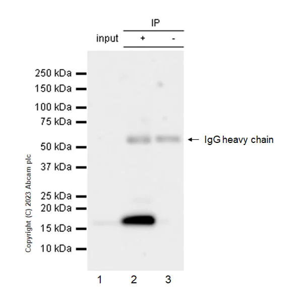 Immunoprecipitation - Anti-HPV18 E7 antibody [EPR26911-29] (AB308296)