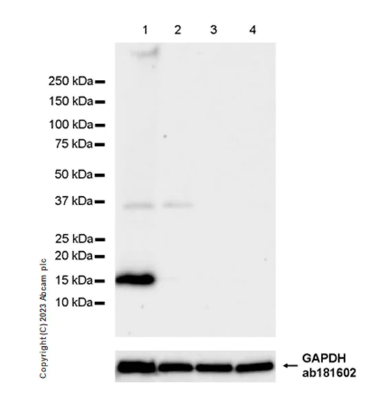 Western blot - Anti-HPV18 E7 antibody [EPR26911-29] (AB308296)